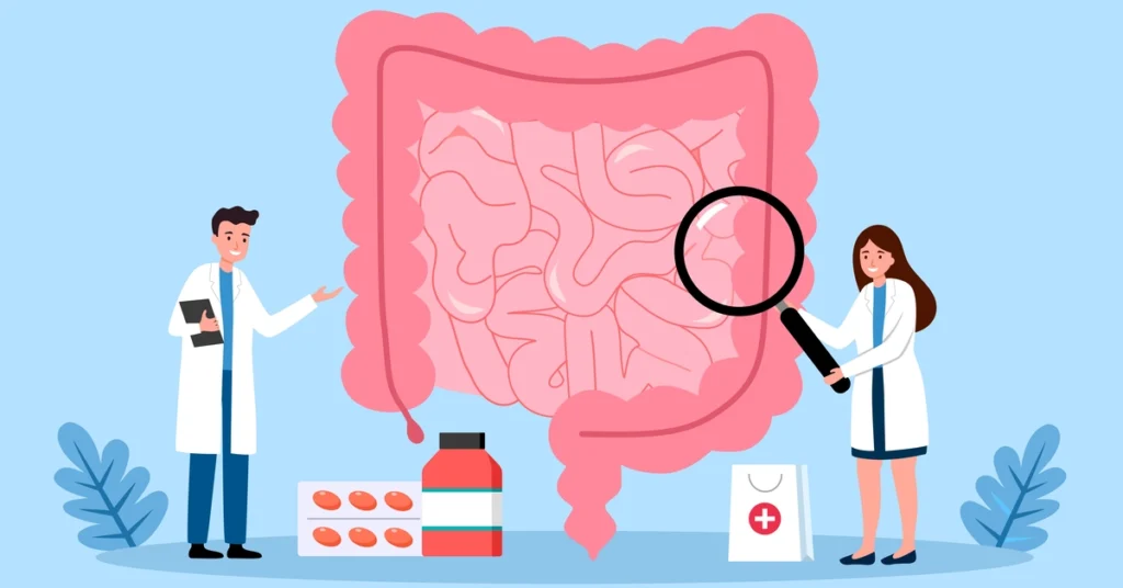 Rysunek przedstawiający badanie jelita przez lekarzy