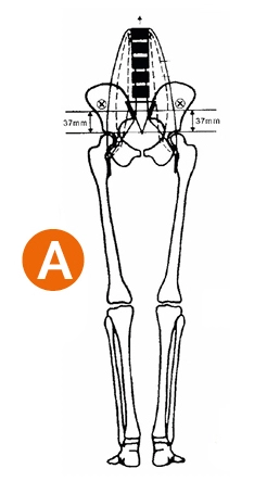 Rysunek przedstawiający prawidłową statykę miednicy