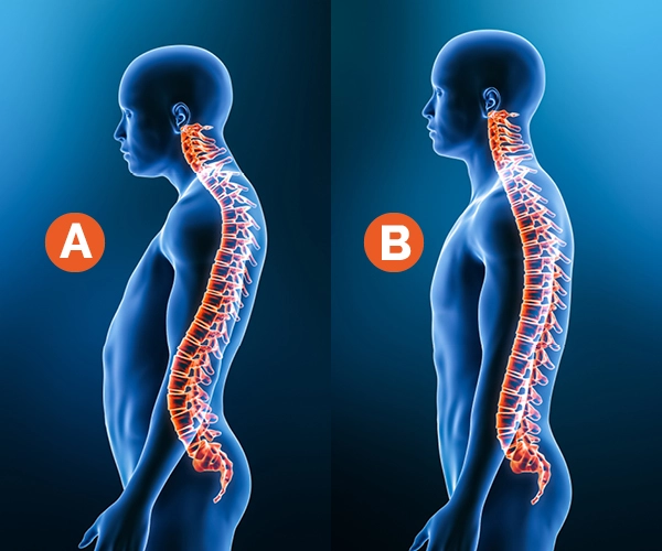 Rysunek przedstawiający prawidłową i nieprawidłową postawę ciała