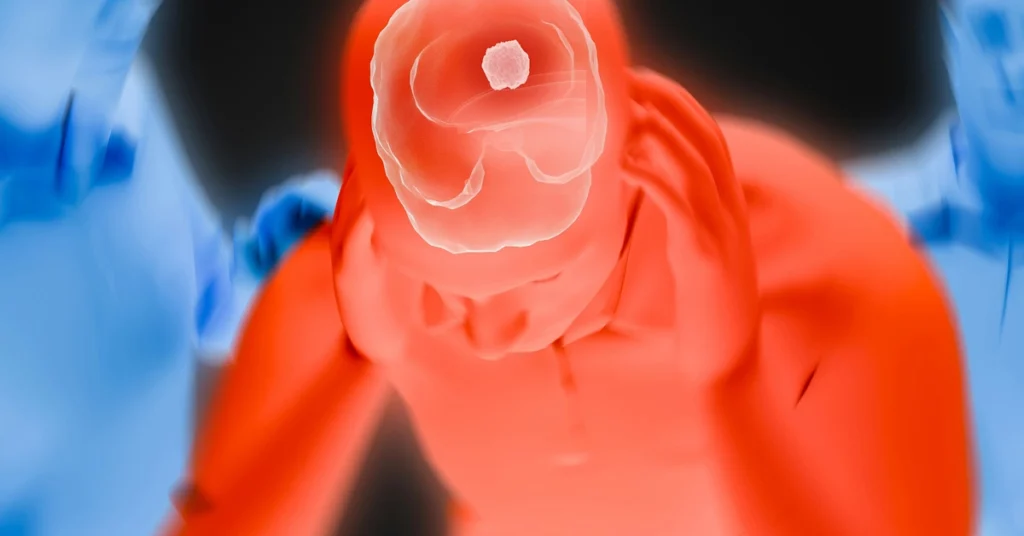 Człowiek w stresie trzyma się za głowę